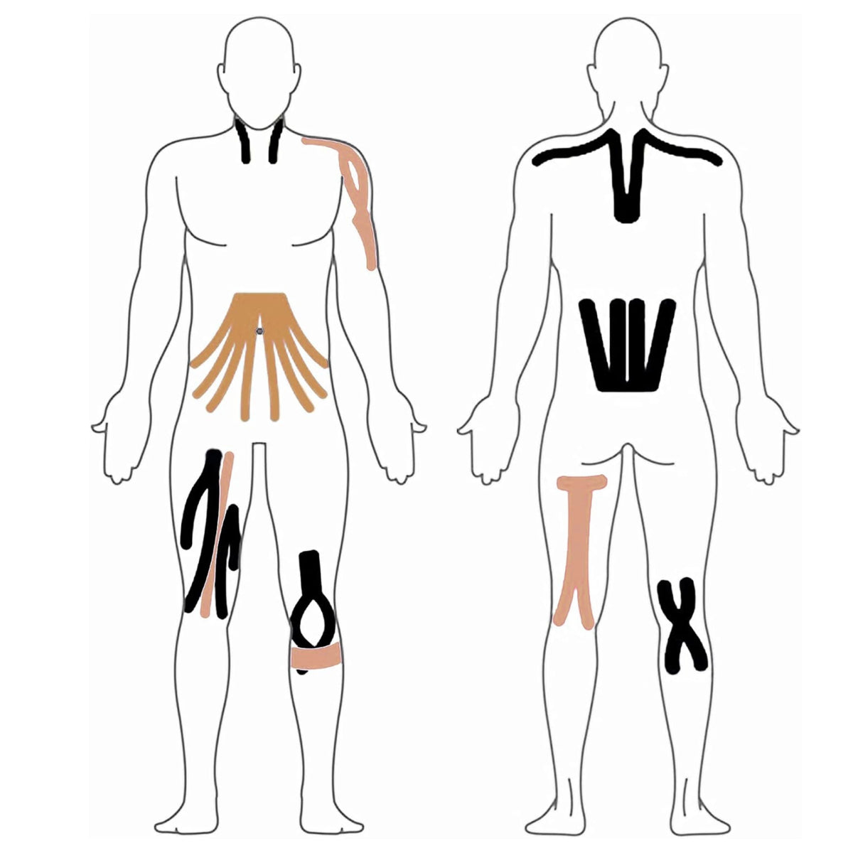 Kinesioteip SPORT PRO 5 m x 5 cm, kollane - Ostuklikk