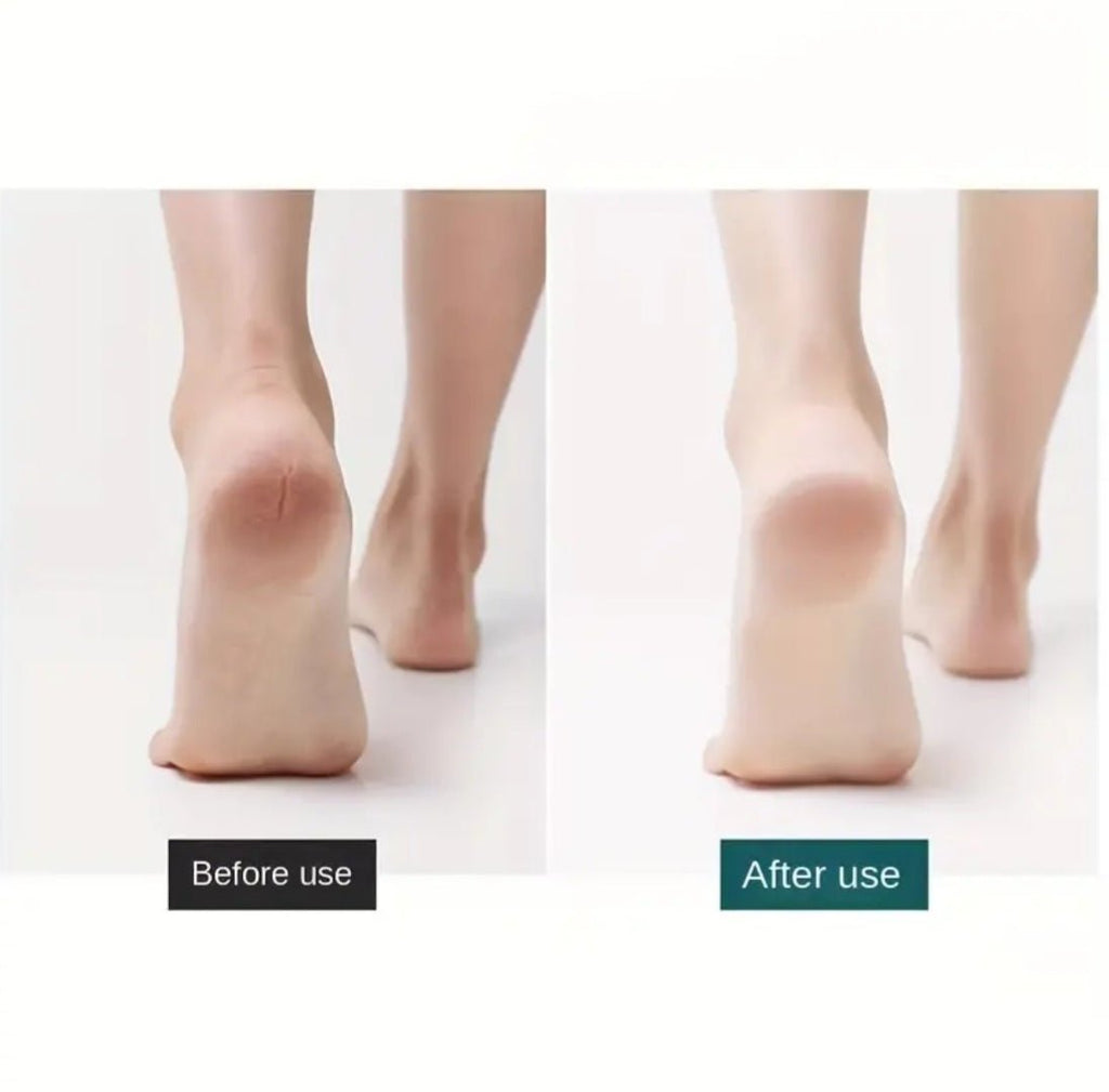 Roostevabast terasest paksu nahapaksendi eemaldaja koos 10 varutera (10 tk)