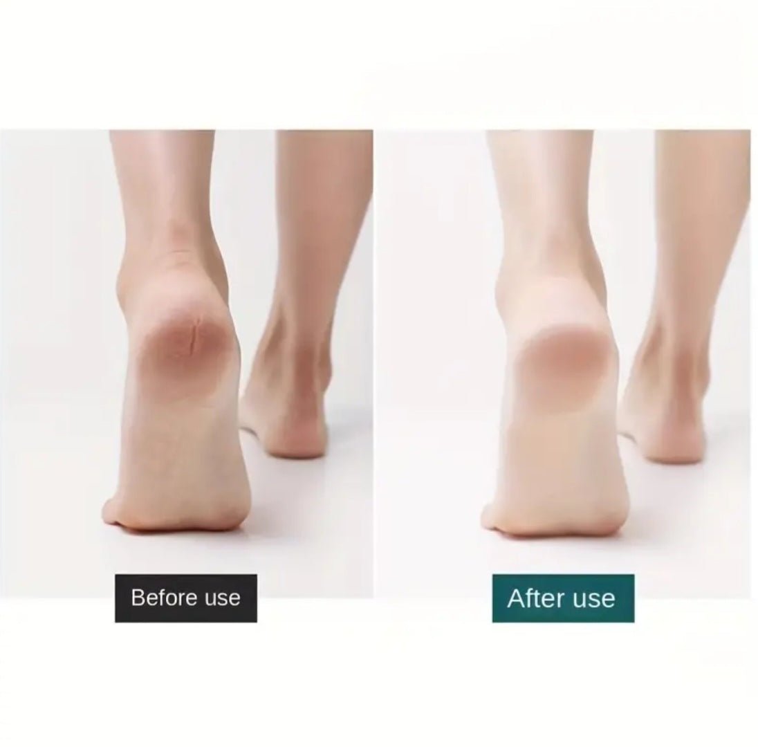 Roostevabast terasest paksu nahapaksendi eemaldaja koos 10 varutera (10 tk)